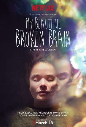 My Beautiful Broken Brain Download